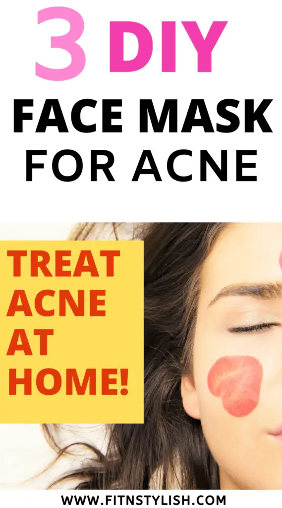 homemade face mask for acne: diy face mask for acne